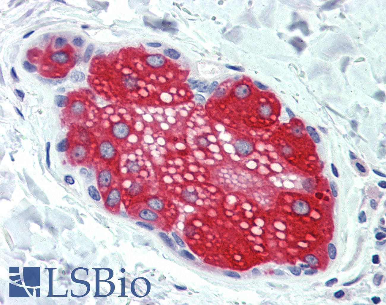 IHC-plus™ Polyclonal Rabbit anti-Human SUSD2 Antibody (Internal)