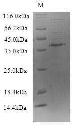 Dog Trypsin Protein (Recombinant 6His-SUMO, N-terminus)