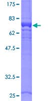 Human G6PC / Glucose-6-Phosphatase Protein (Recombinant GST, N-terminus)