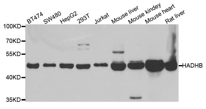 IHC-plus™ Polyclonal Rabbit anti-Human HADHB Antibody (IHC, IF, WB)