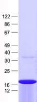 Human ZNF69 Protein (Recombinant His, N-Terminal)