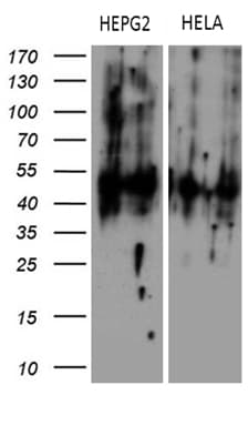 KRT16 / CK16 / Cytokeratin 16 Antibody (clone OTI2F3)