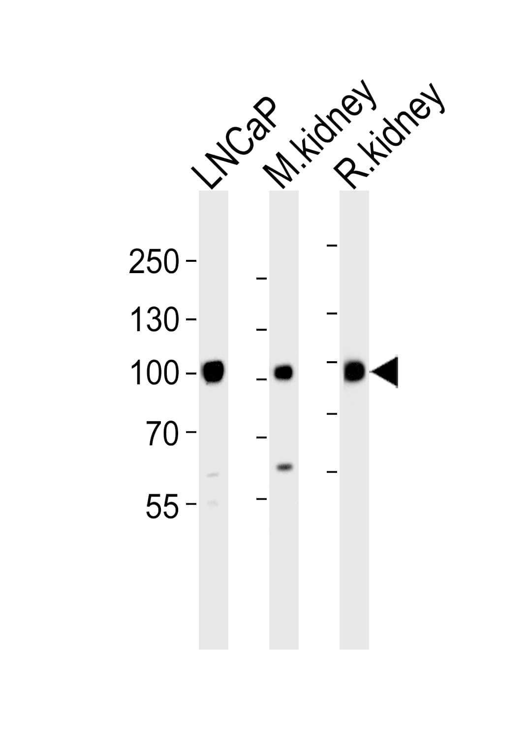 MME / CD10 Antibody (aa99-132)