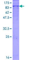 Human GUSB / Beta Glucuronidase Protein (Recombinant GST)