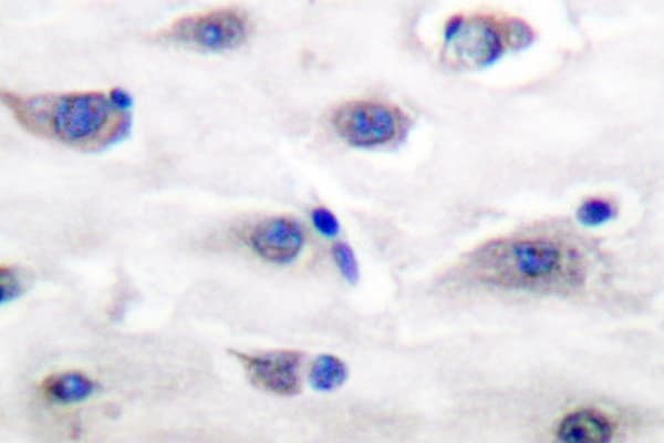 GRIA1 / GLUR1 Antibody (Ser857)