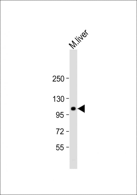GART / GARS Antibody (C-Terminus)