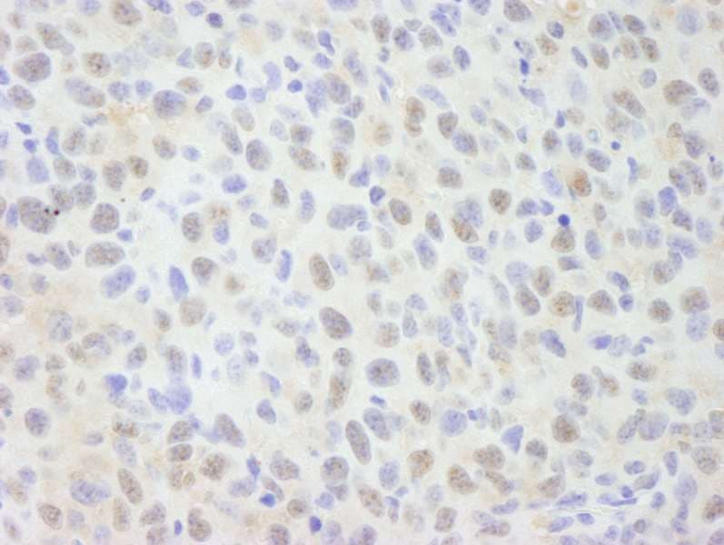 SNW1 / SKIP Antibody (aa450-500)