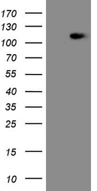 Monoclonal Mouse anti-Human MED15 / ARC105 Antibody (clone OTI1A2, Carrier-free, aa393-679, WB)