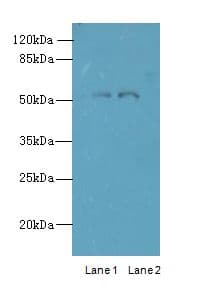 Polyclonal Rabbit anti-Human TRIM17 / RNF16 Antibody (IHC, WB)