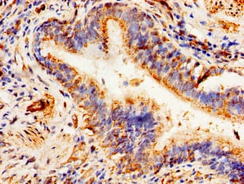 ALDP / ABCD1 Antibody