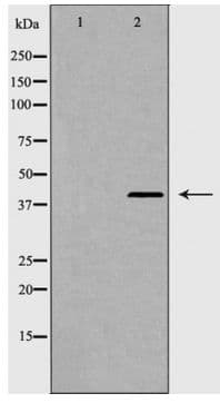 Polyclonal Rabbit anti-Human CCR7 Antibody (IF, WB)