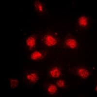 RB1 / Retinoblastoma / RB Antibody (C-Terminus)