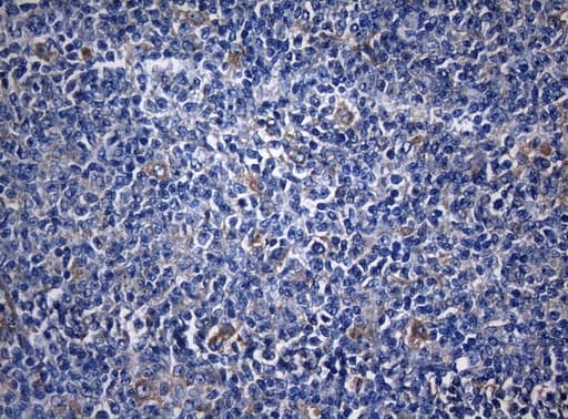 ZNF394 Antibody (aa1-296, clone OTI1G9)
