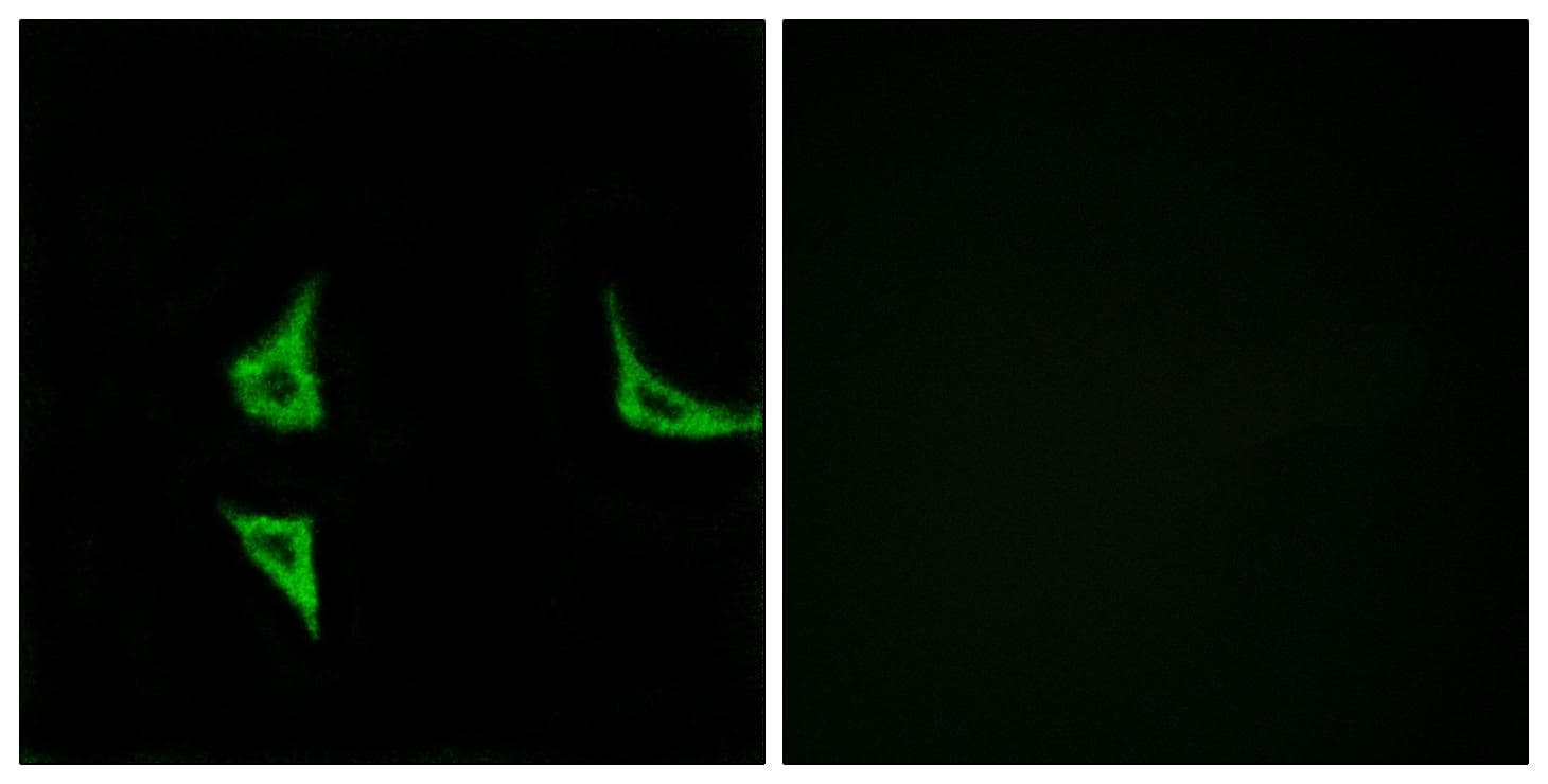 CAMK2 / CAMKII Antibody (phospho-Thr286)