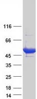 Human TP / Thymidine Phosphorylase Protein (Recombinant Myc-DDK (Flag))