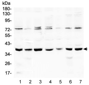 RAD51 / RECA Antibody