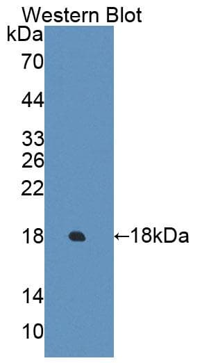C2orf40 / ECRG4 Antibody (aa32-148)