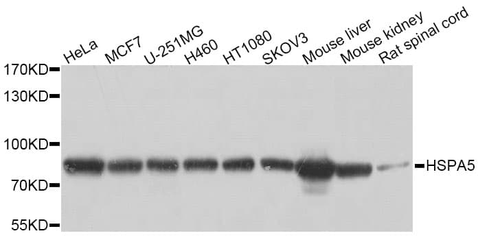 HSPA5 / GRP78 / BiP Antibody