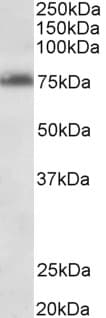 IHC-plus™ Polyclonal Goat anti-Human TSPYL2 / DENTT Antibody (aa441-454, IHC, WB)