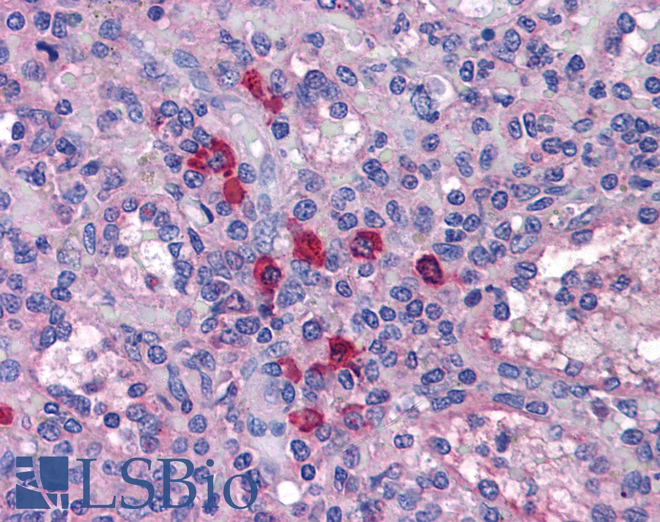 IHC-plus™ TLR7 / CD287 Antibody (aa465-483)