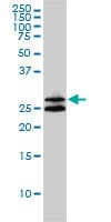 Monoclonal Mouse anti-Human ASB9 Antibody (clone 1D8, WB)