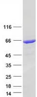 Human GLS / Glutaminase Protein (Recombinant Myc-DDK (Flag))