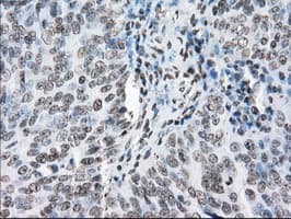 CYPOR / POR Antibody (clone OTI5B3)