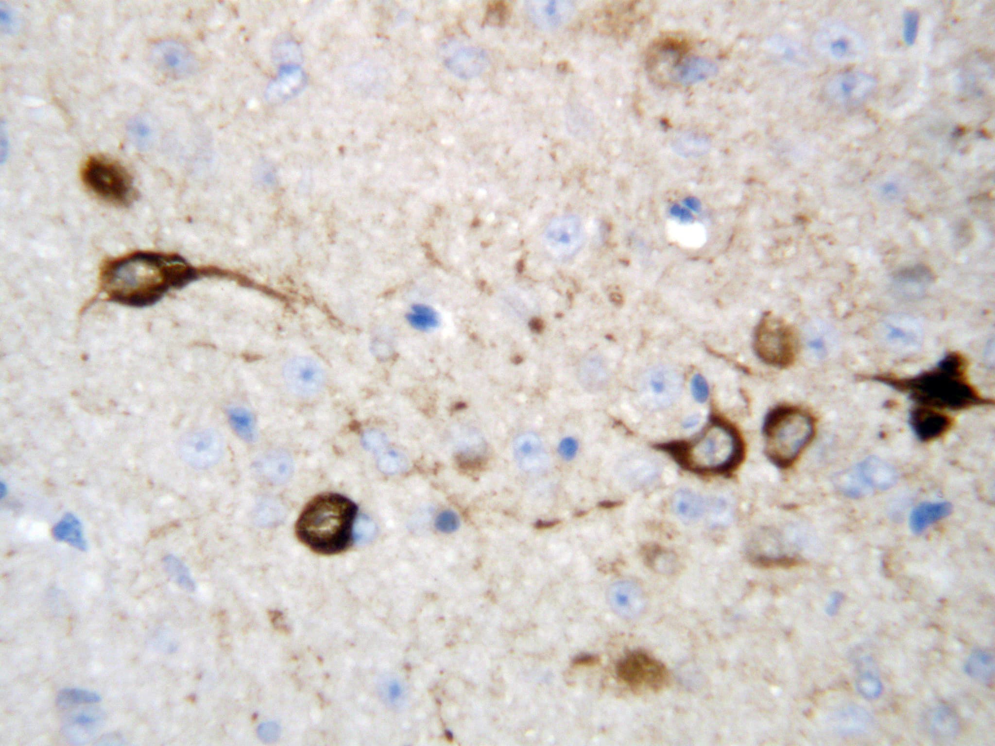 CAMKK2 Antibody (aa180-194)