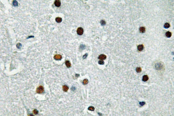 ASCL1 / MASH1 Antibody (aa109-158)