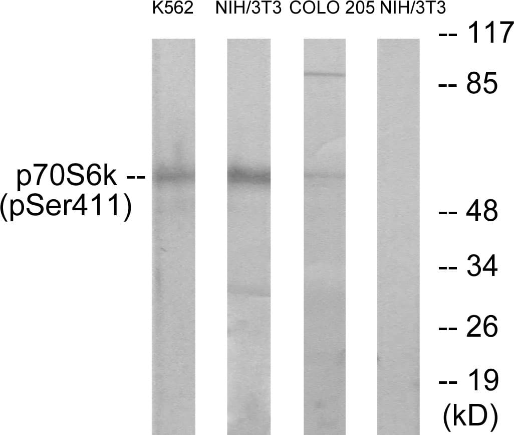 RPS6KB1 / P70S6K / S6K Antibody (phospho-Ser411)