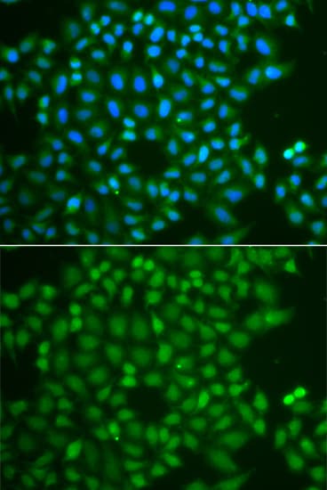 Polyclonal Rabbit anti-Human UCHL5 / UCH37 Antibody (IHC, IF, WB)