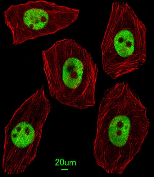 UNCX Antibody (aa382-410)