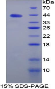 Mouse NPPC Protein (Recombinant His-GST)