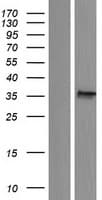 ACBD4 Protein (Over-Expression Lysate Myc-DDK (Flag))