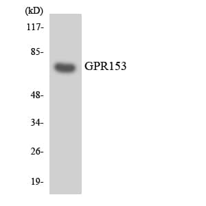 PGR1 / GPR153 Antibody (aa185-234)