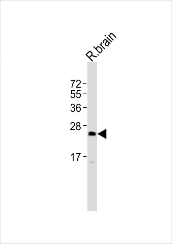 UPK2 / UPII / Uroplakin 2 Antibody