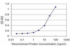 DLX5 Antibody (clone 1B7)