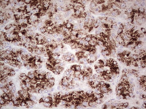 ANGPT1 / Angiopoietin-1 Antibody (aa198-498, clone OTI8H2, Carrier-free)