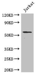 SPPL2A / IMP3 Antibody