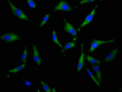 SLC34A3 / NaPi-2c Antibody
