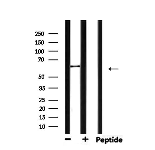 Polyclonal Rabbit anti-Human MMP14 Antibody (IHC, IF, WB)
