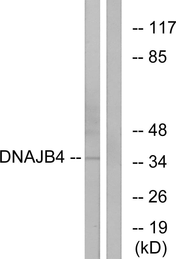 DNAJB4 Antibody (aa91-140)