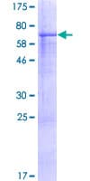 Human WDR34 Protein (Recombinant GST)