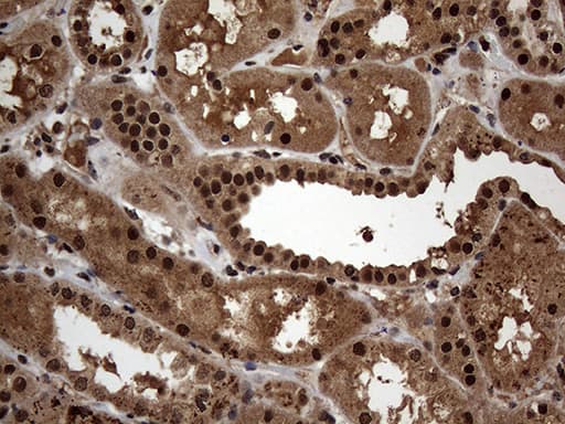 SSU72 Antibody (clone OTI5A1)