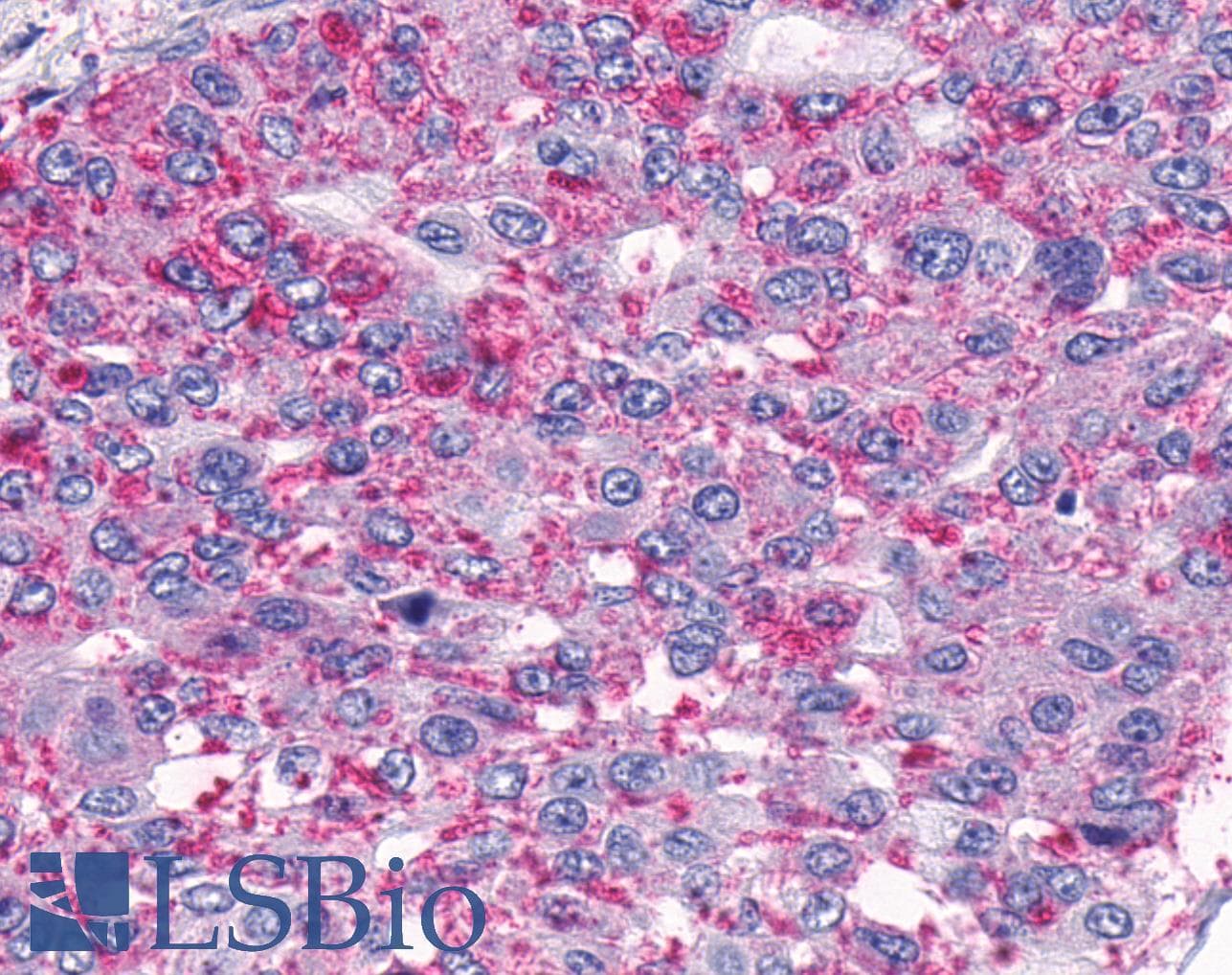 PathPlus™ ADGRA2 / GPR124 Antibody (N-Terminus)