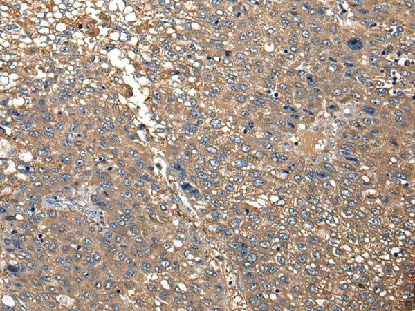 DGK-IOTA / DGKI Antibody