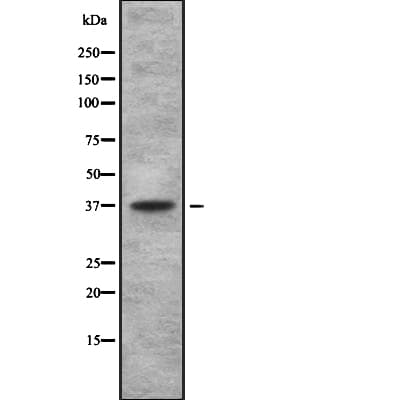 Thromboxane A2 Receptor Antibody