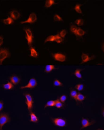 CD44 Antibody
