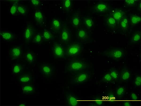 Monoclonal Mouse anti-Human DDX56 Antibody (clone 4C5, IHC, IF, WB)