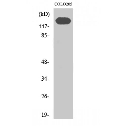 CDH2 / N Cadherin Antibody (690-770 aa, C-terminal)